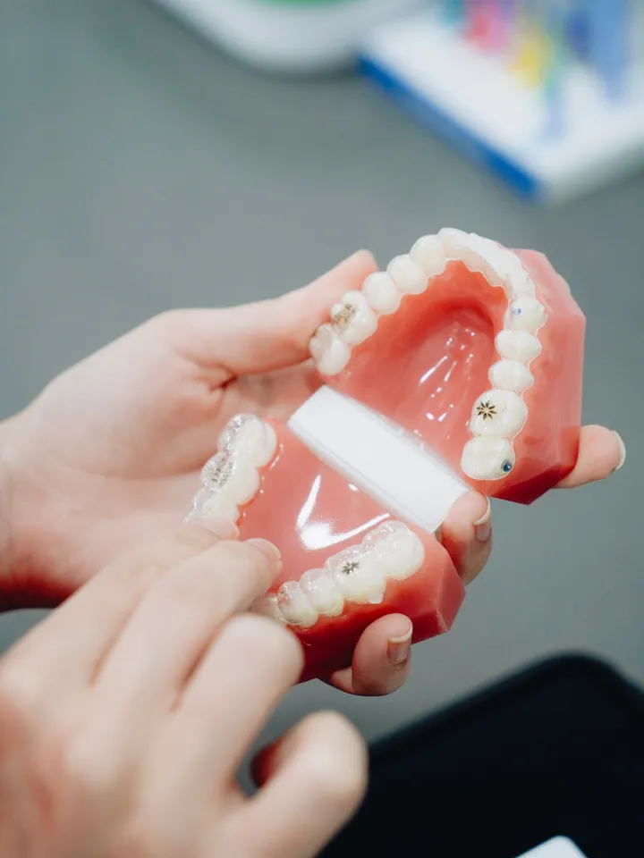 Prótese dentária feita sob medida